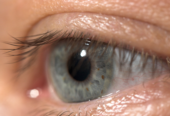 Augen-OP verringert auch Demenz-Risiko (Foto: Adpic) Auge