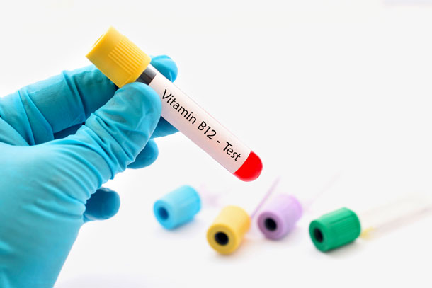 Vitamin B12, Test (Foto: 123RF, J. Ontakrai) Sich vegan ernährende Personen sollten regelmässig ihren Vitamin-B12-Status kontrollieren lassen.
