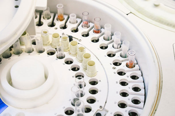 A complete blood count can provide information about your immune status. (Photo: 123RF, keeratipreechanugoon) Blood analyzer