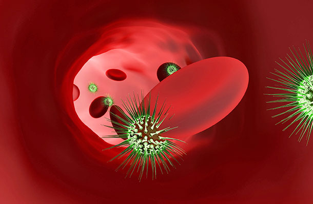 Symptome einer Blutvergiftung (Illustration: 123RF, D. Kotin) Steigt das Fieber oder stellt sich Schüttelfrost ein, sollte man sich in medizinische Behandlung begeben.
