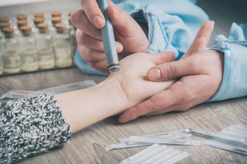 Moxibustion ist eine Behandlung mit Wärme.