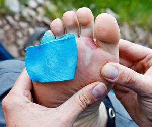 Ampoules aux pieds