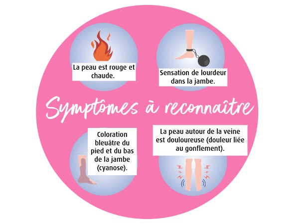 thrombose symptômes