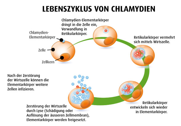 Chlamydien: Trickreiche Bakterien (Illustration: 123RF, Designua) Infografik: Lebenszyklus von Chlamydien