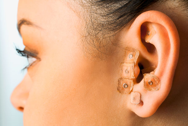 Acupuncture de l'oreille (Photo: Shutterstock, Karelnoppe) Certains points de l'oreille sont connectés aux organes et à d'autres points importants du corps.