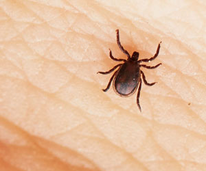 Zecke Haut (Foto: 123RF, Jaromir Chalabala) Eine kleine schwarze Zecke krabbelt über die Haut eines Mannes.