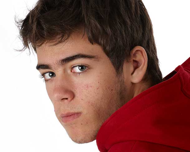 Junge-Teenager-Akne Pickel Boutons