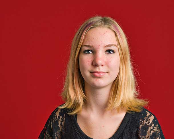 Akne Pickel Bouton Mädchen