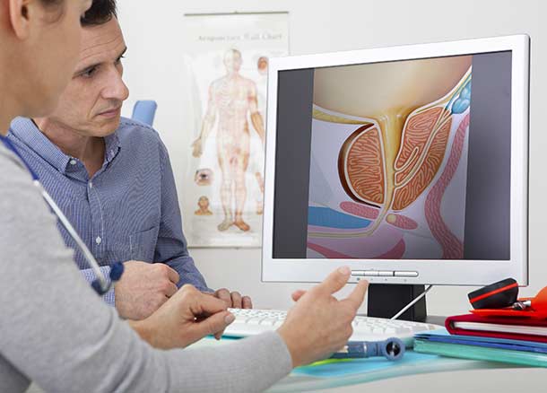 Prostatite ou Inflammation de la prostate : causes, symptômes et solutions (Photo : panthermedia_B42548065_3508x2339) Prostatite ou Inflammation de la prostate : causes, symptômes et solutions