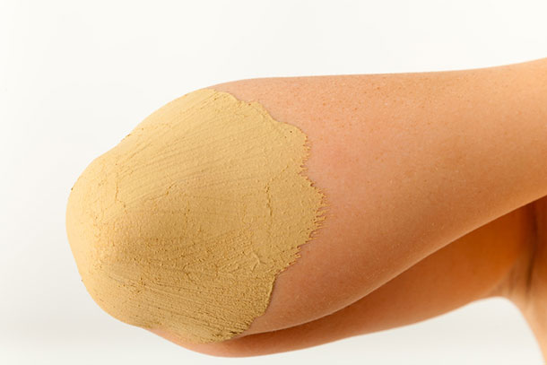 Psoriasis: Die richtige Hautpflege (Foto: Fotolia, Lorenz Tim) Bei gereizter Haut hilft eine Maske, die aus feinstgemahlenen Haferflocken, Heilerde und gemahlenen Mandeln plus etwas Wasser zu einer schleimigen Konsistenz angerührt wird. (Foto: Arm mit Heilerdemaske. Fotolia, Lorenz Tim)