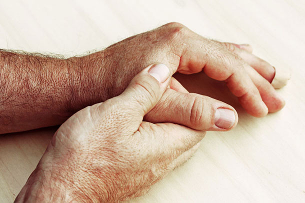 Psoriasis: Schmerzhafter Begleiter der Schuppenflechte. (Foto: Im Fokus Männerhände. Die Einte Hand hält das Daumengelenk der Anderen. 123RF, Astrid Gast)