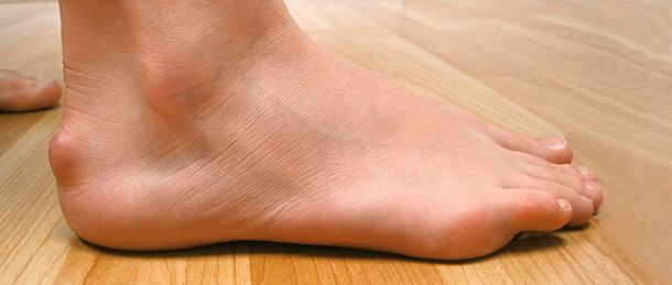 Überbein Überbein