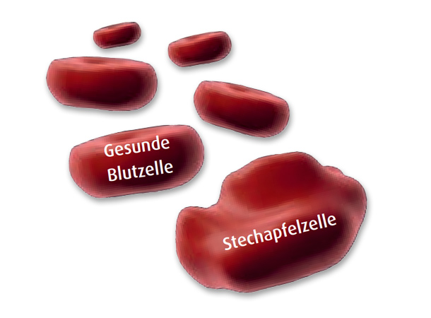 Stechapfelzellen (Foto: EMPA) Stechapfelzellen