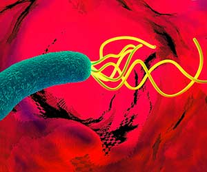 Magenentzündung (Gastritis): Helicobactor pylori Helicobactor pylori